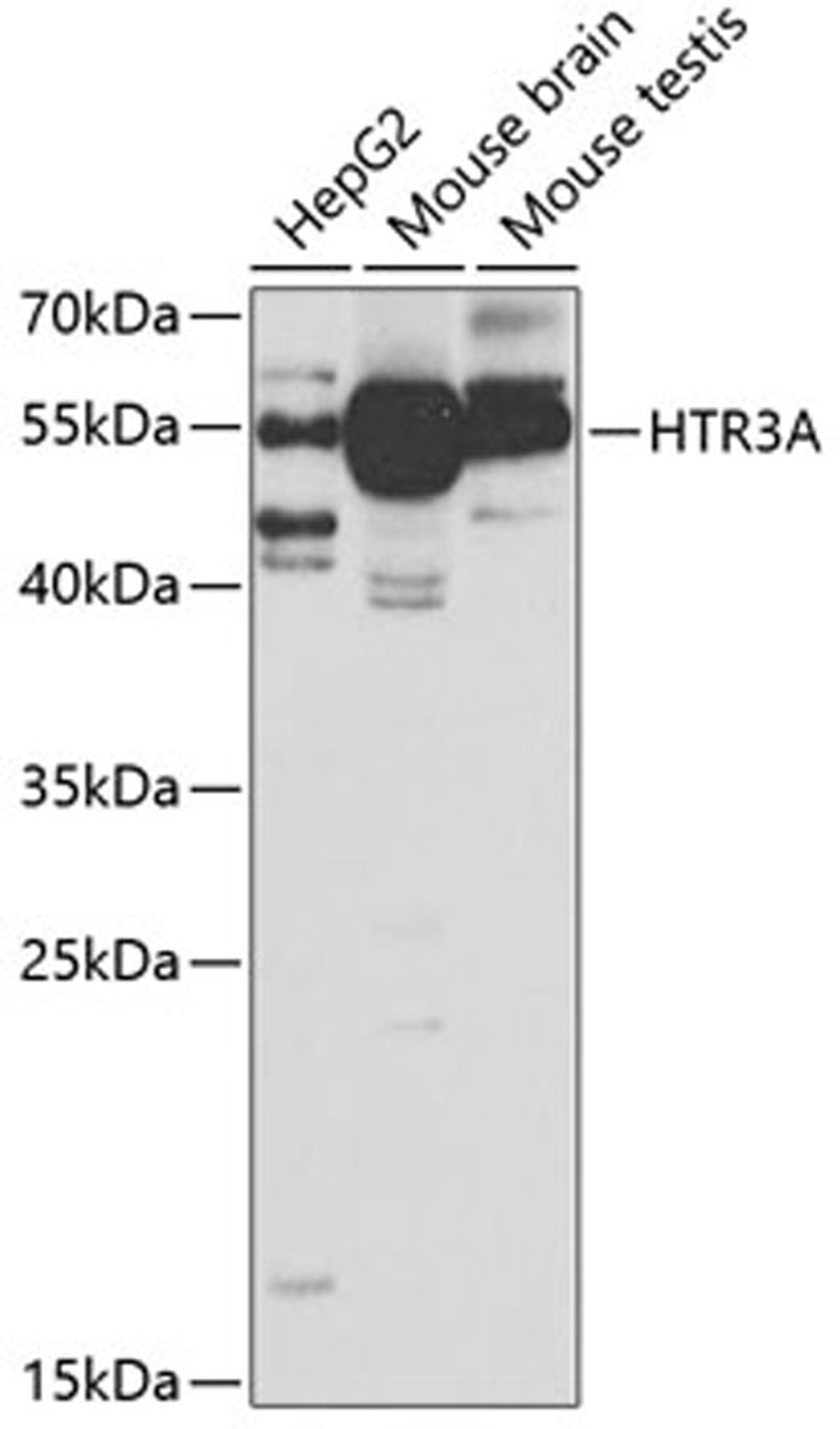 Western blot - HTR3A antibody (A5647)