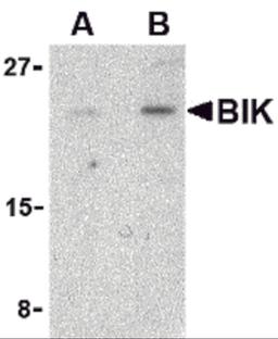 Western blot analysis of BIK in Jurkat cell lysate with BIK antibody at (A) 1 and (B) 2 μg/mL.