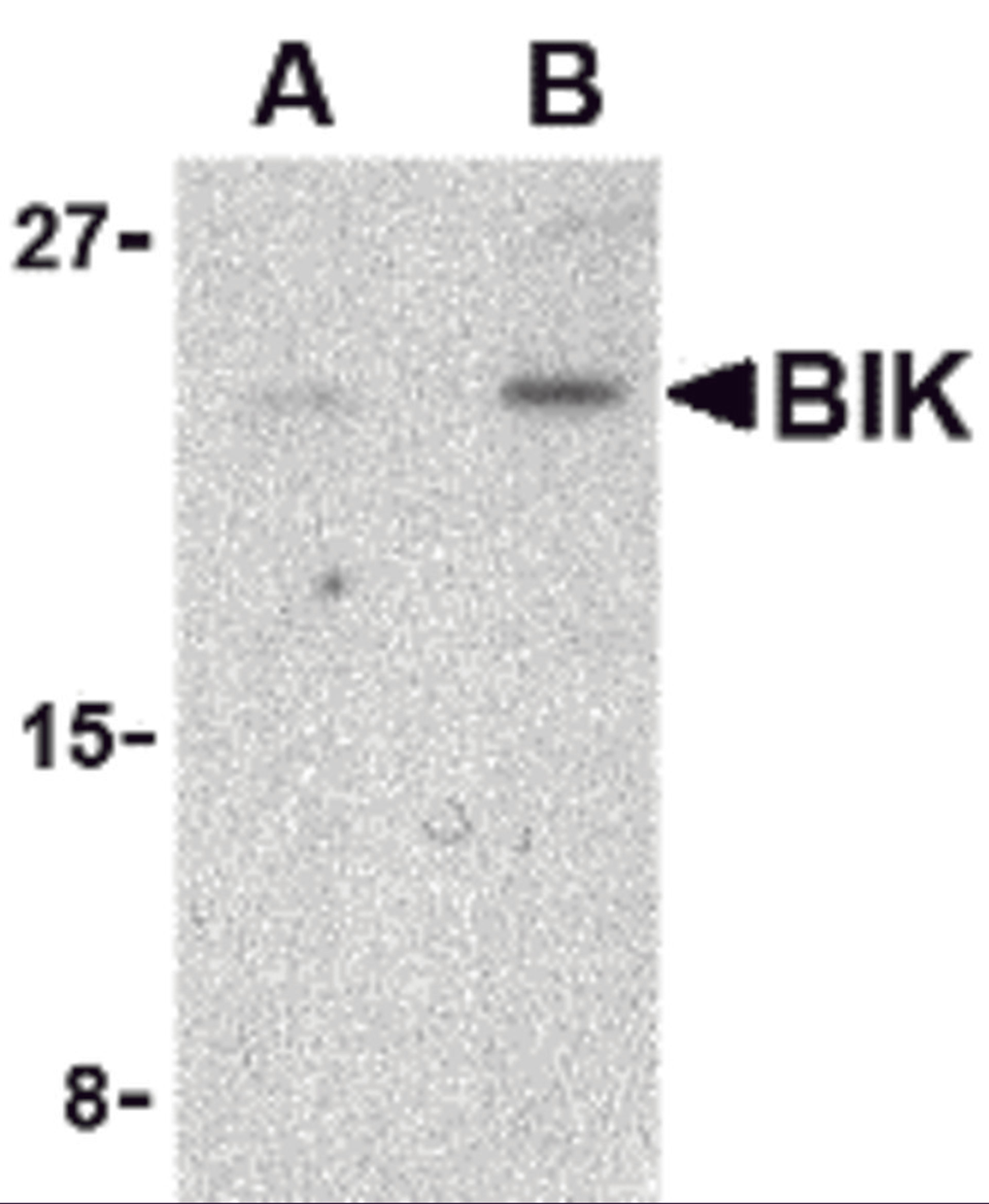 Western blot analysis of BIK in Jurkat cell lysate with BIK antibody at (A) 1 and (B) 2 μg/mL.