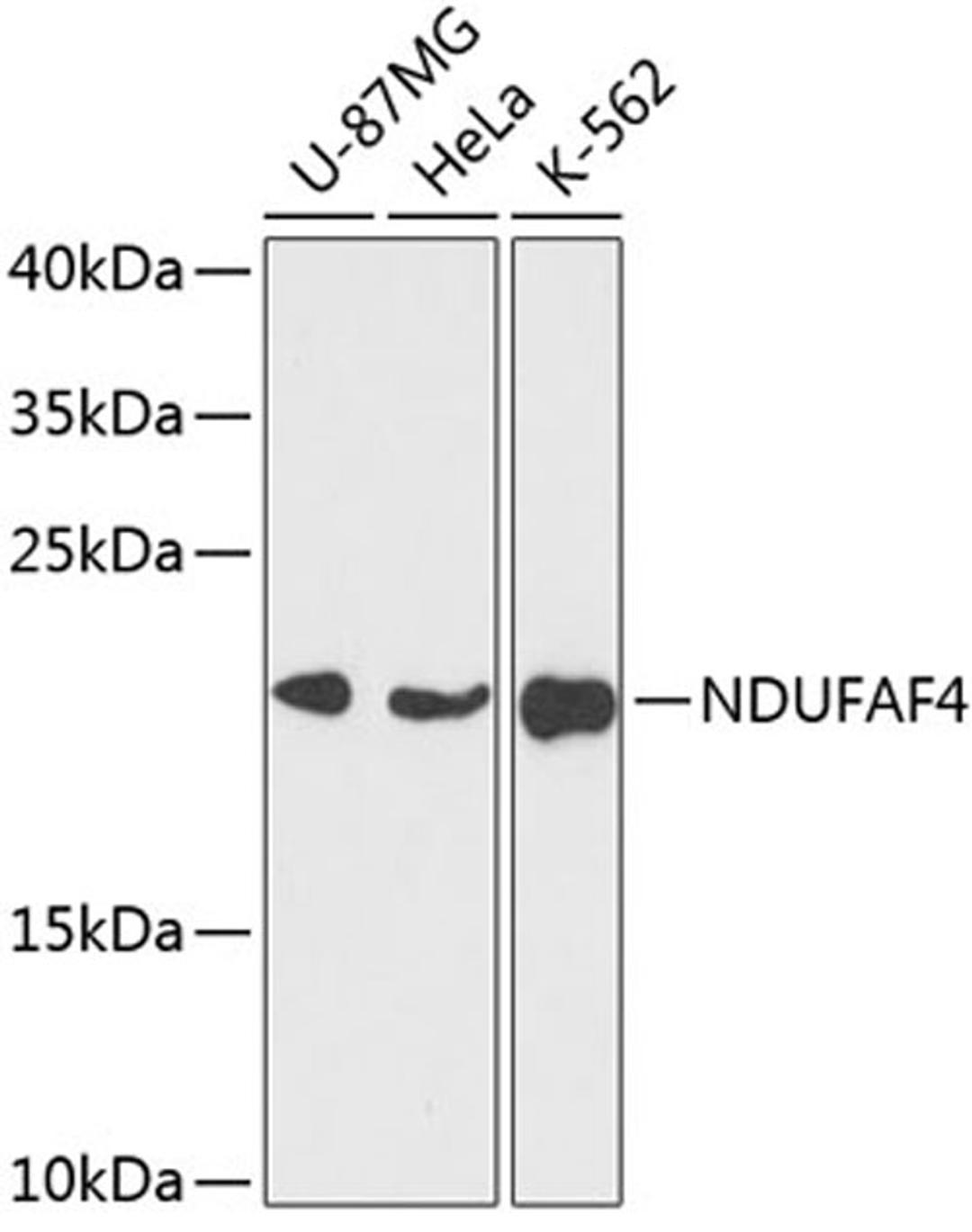 Western blot - NDUFAF4 antibody (A14345)