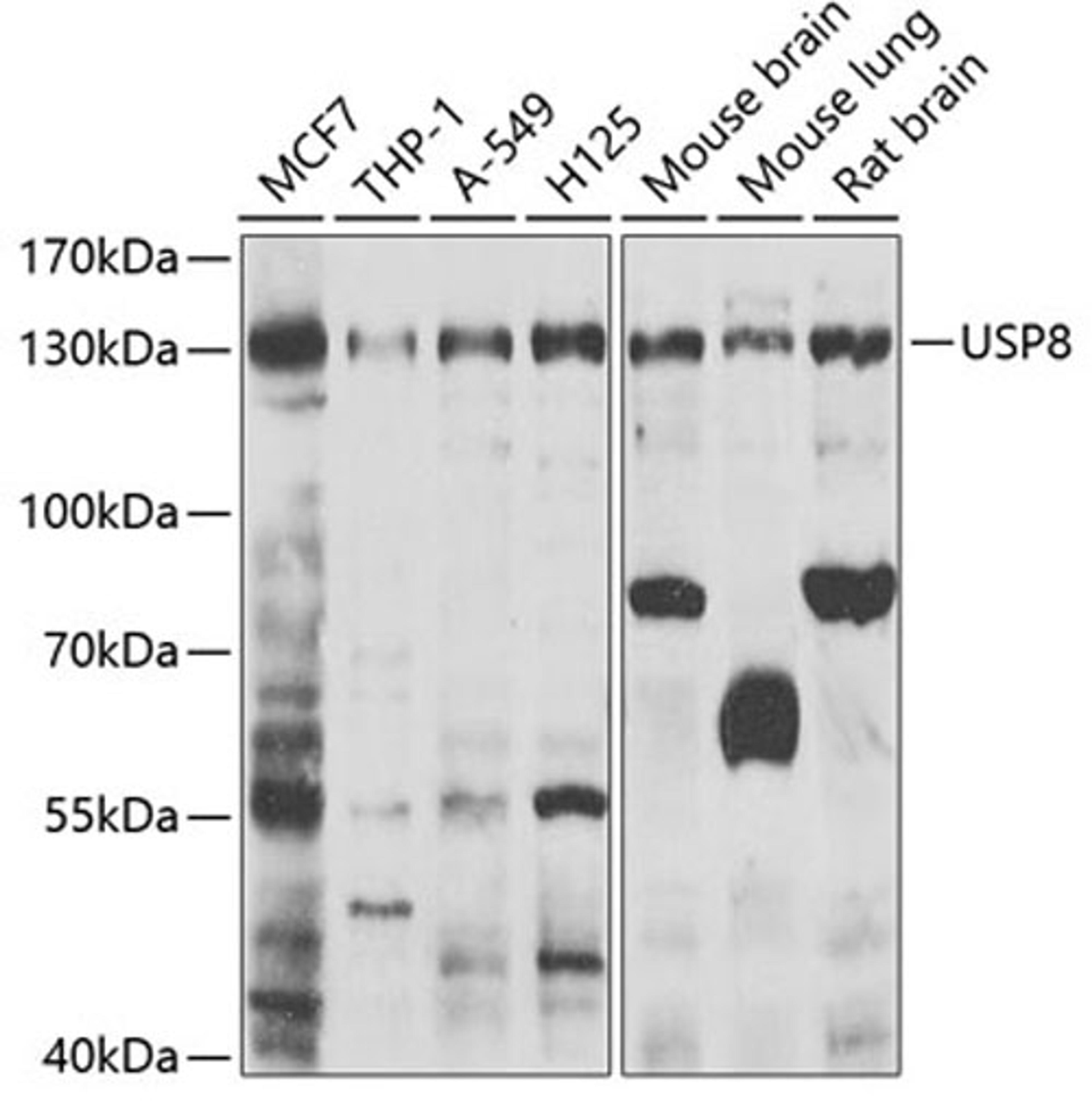 Western blot - USP8 antibody (A7031)