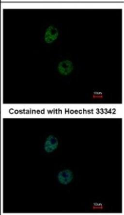 Immunocytochemistry/Immunofluorescence: PATZ Antibody [NBP2-19708] - Immunofluorescence analysis of paraformaldehyde-fixed HeLa, using antibody at 1:500 dilution.