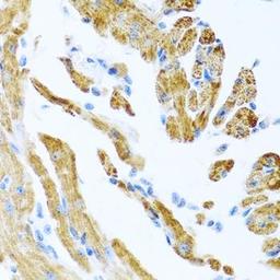 Immunohistochemical staining of mouse heart tissue using COL9A3 antibody (dilution of 1:100)