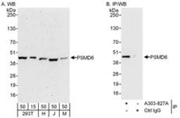 Detection of human and mouse PSMD6 by western blot (h and m) and immunoprecipitation (h).