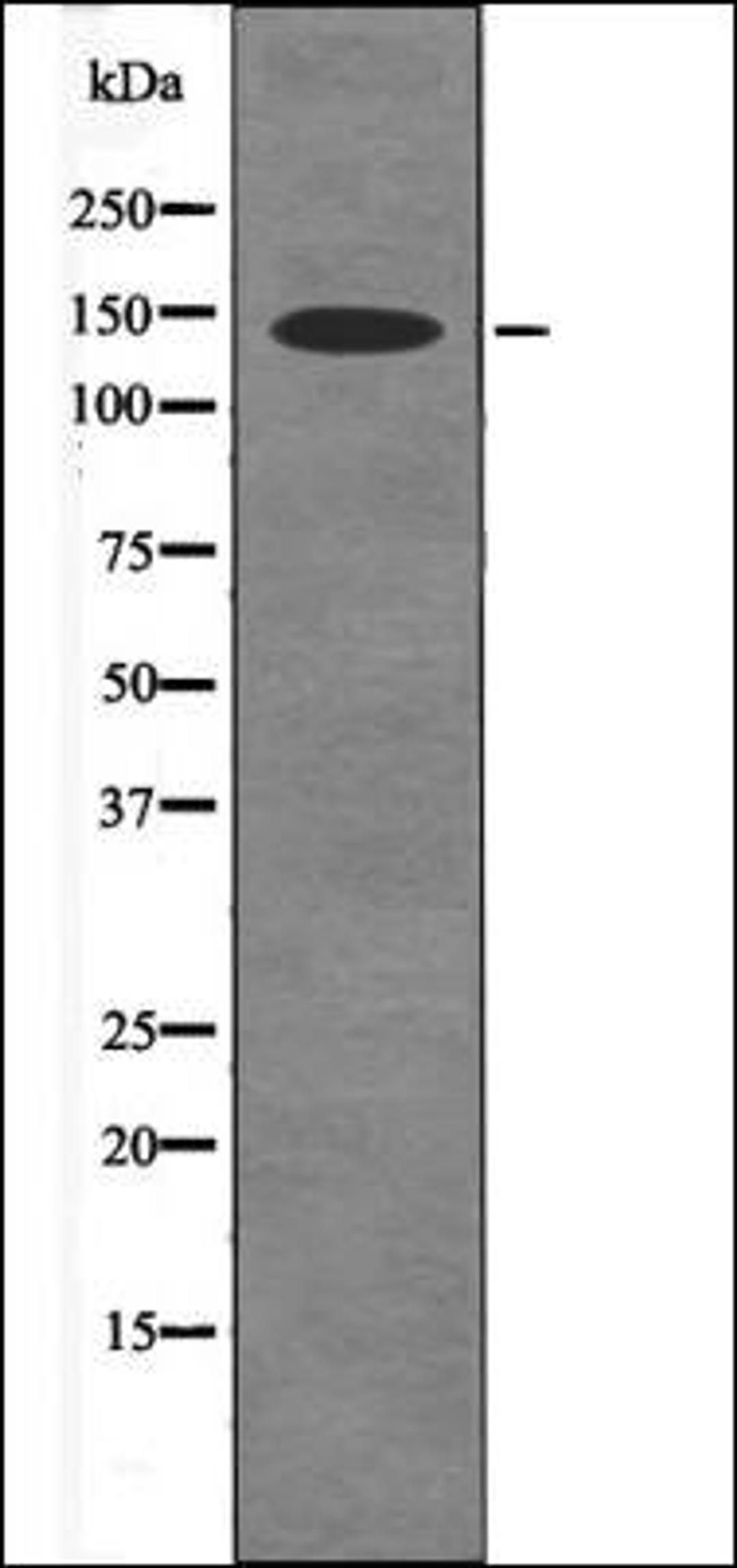 Western blot analysis of HeLa whole cell lysates using eNOS -Phospho-Ser114- antibody