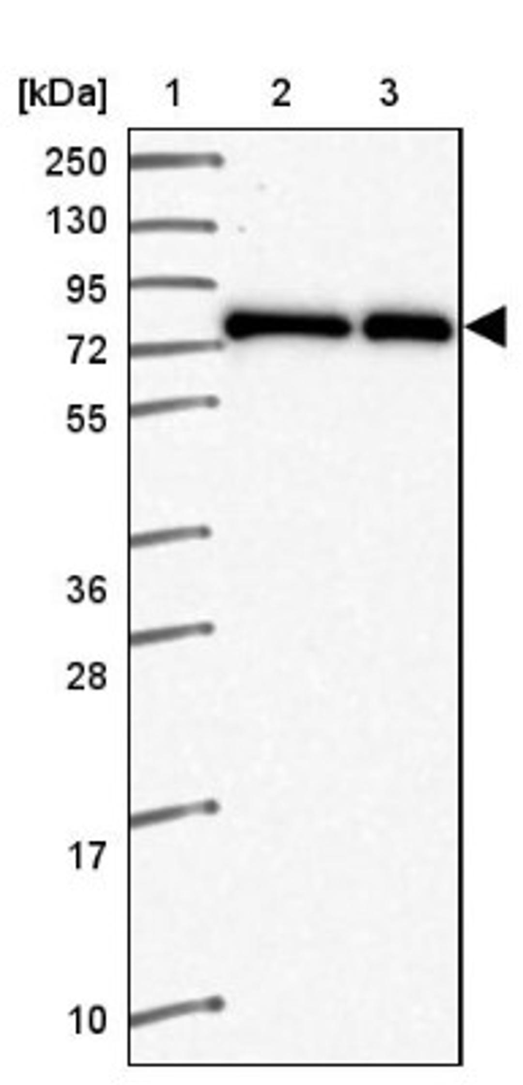 Western Blot: ZNF778 Antibody [NBP2-33637] - Lane 1: Marker [kDa] 250, 130, 95, 72, 55, 36, 28, 17, 10<br/>Lane 2: Human cell line RT-4<br/>Lane 3: Human cell line U-251MG sp