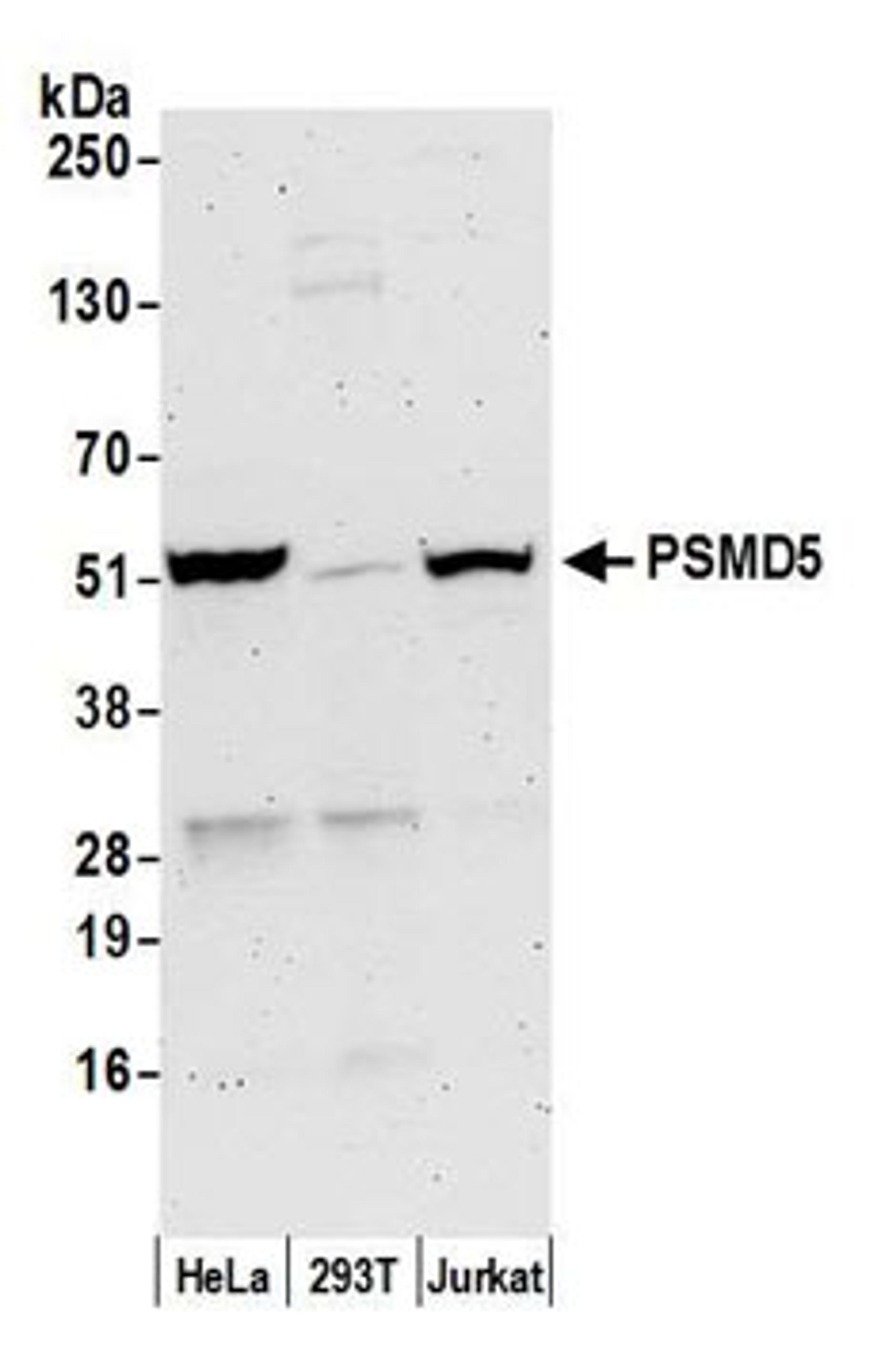 Detection of human PSMD5 by western blot.