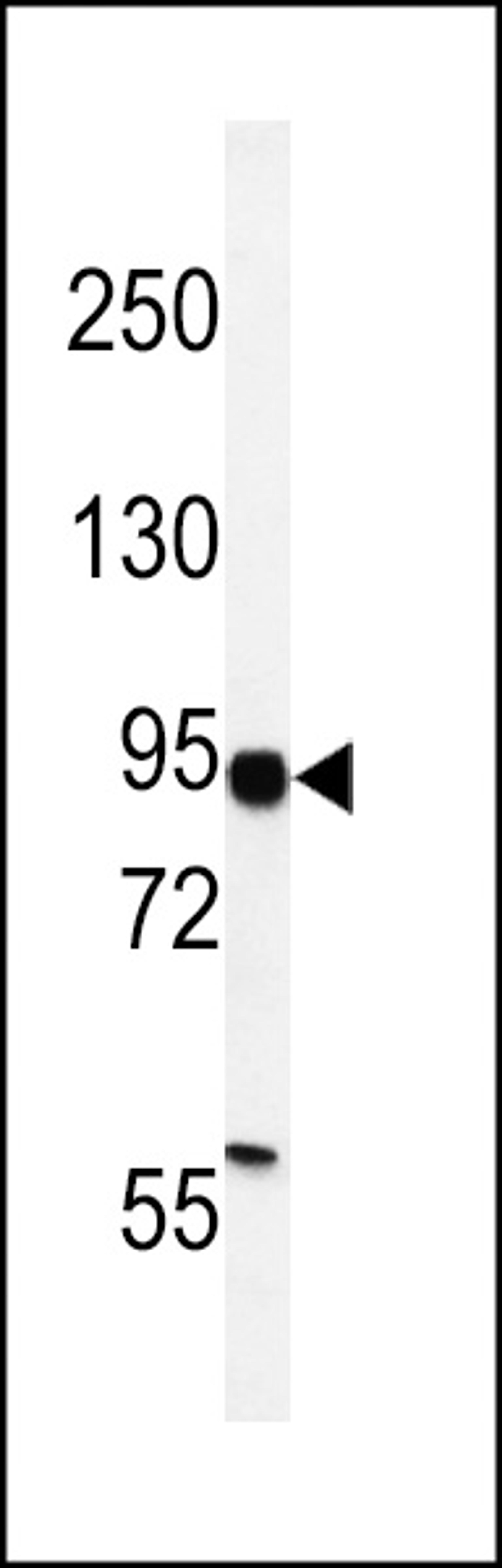 Western blot analysis of HIF1Alpha Antibody in MDA-MB231 cell line lysates (35ug/lane)