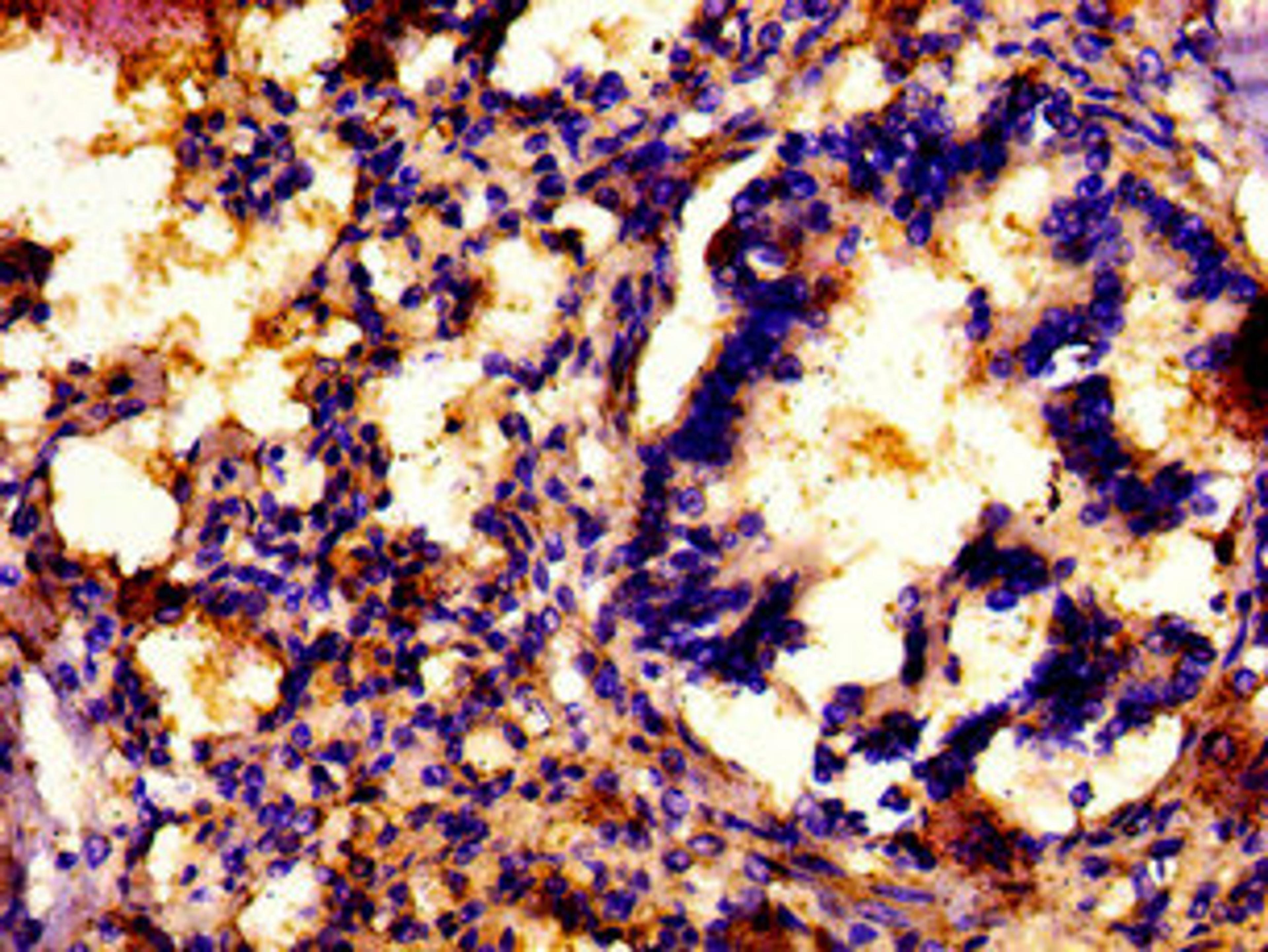 IHC image of CSB-PA863972LA01HU diluted at 1: 500 and staining in paraffin-embedded human lung tissue performed on a Leica BondTM system. After dewaxing and hydration, antigen retrieval was mediated by high pressure in a citrate buffer (pH 6.0) . Section was blocked with 10% normal goat serum 30min at RT. Then primary antibody (1% BSA) was incubated at 4°C overnight. The primary is detected by a biotinylated secondary antibody and visualized using an HRP conjugated SP system.