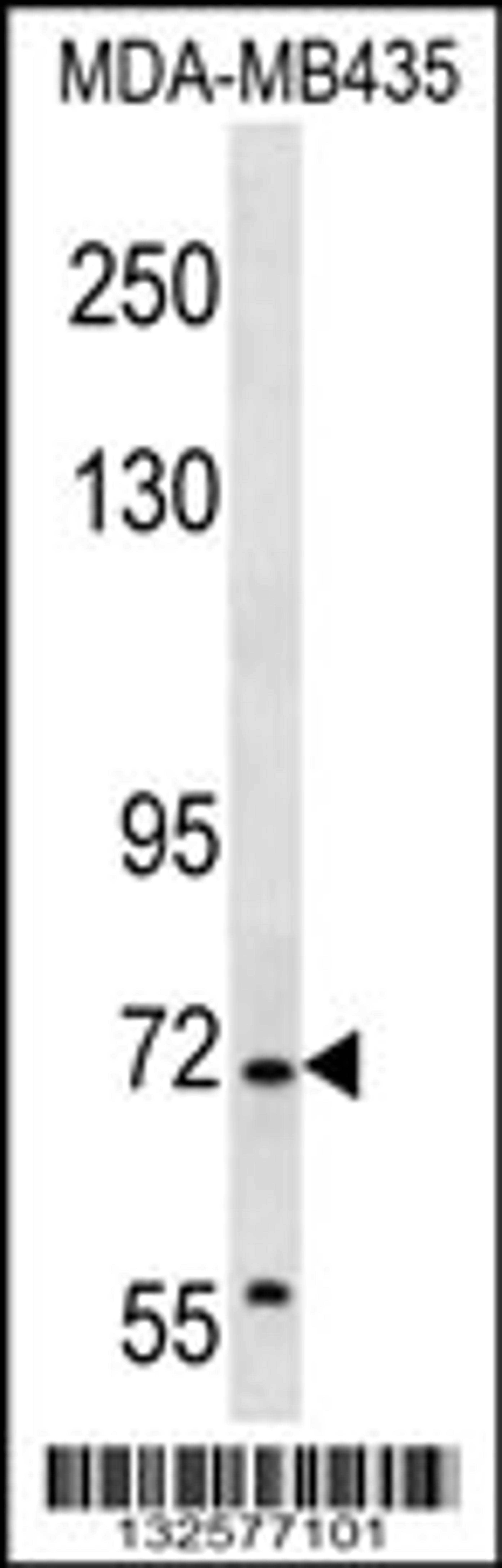 Western blot analysis in MDA-MB435 cell line lysates (35ug/lane).