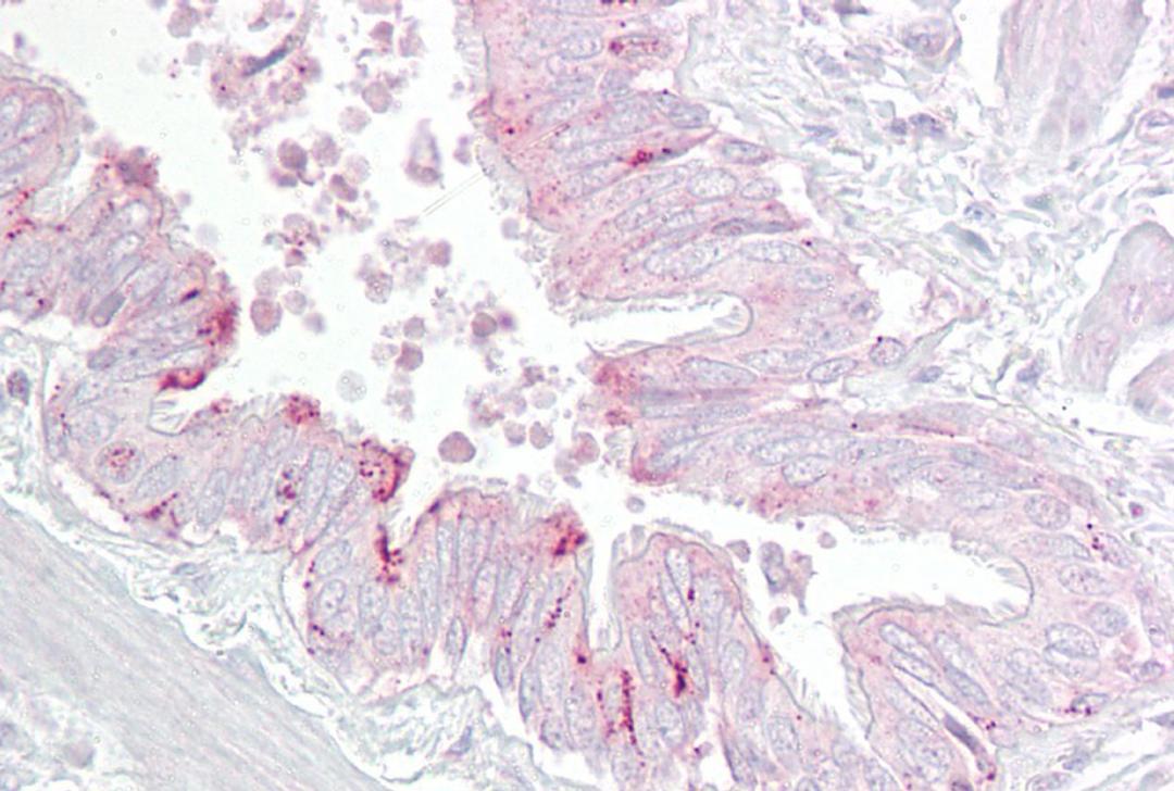 Antibody used in IHC on Human Lung.