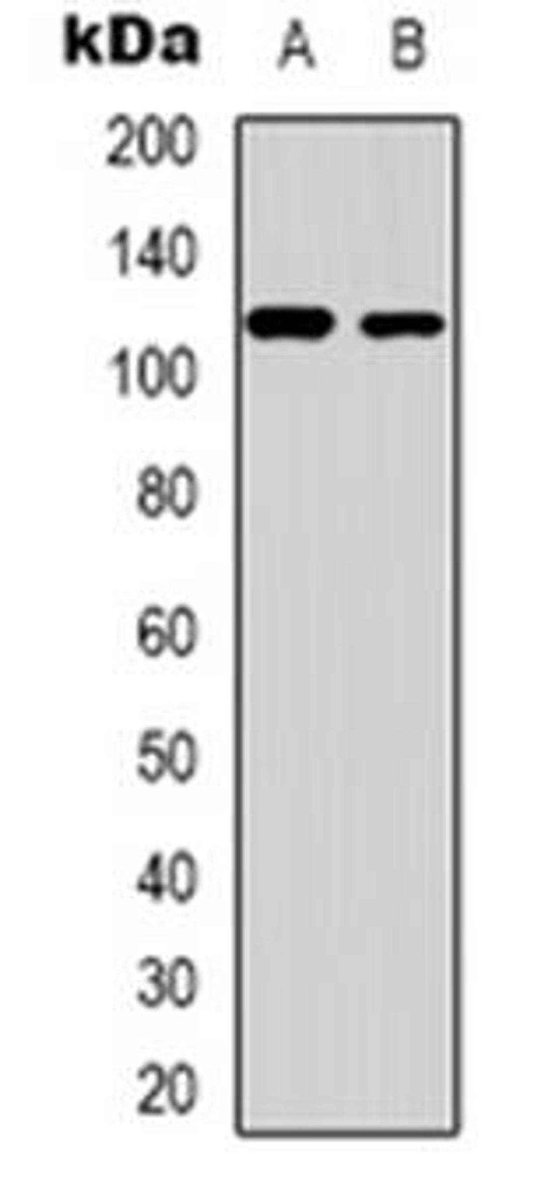 Western blot analysis of ZC3H7B expression in human liver (Lane 1), HEK293T (Lane 2) whole cell lysates using ZC3H7B antibody