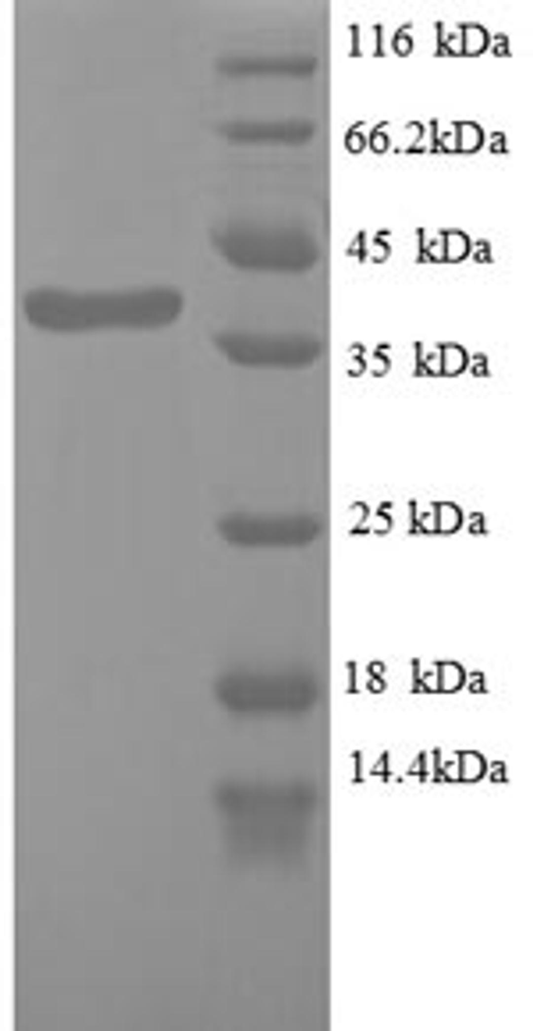 (Tris-Glycine gel) Discontinuous SDS-PAGE (reduced) with 5% enrichment gel and 15% separation gel.