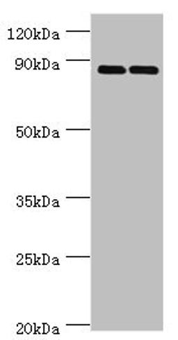 Western blot. All lanes: SET and MYND domain-containing protein 4 antibody at 4ug/ml. Lane 1: HepG2 whole cell lysate. Lane 2: Hela whole cell lysate. Secondary. Goat polyclonal to rabbit IgG at 1/10000 dilution. Predicted band size: 89 kDa. Observed band size: 89 kDa. 