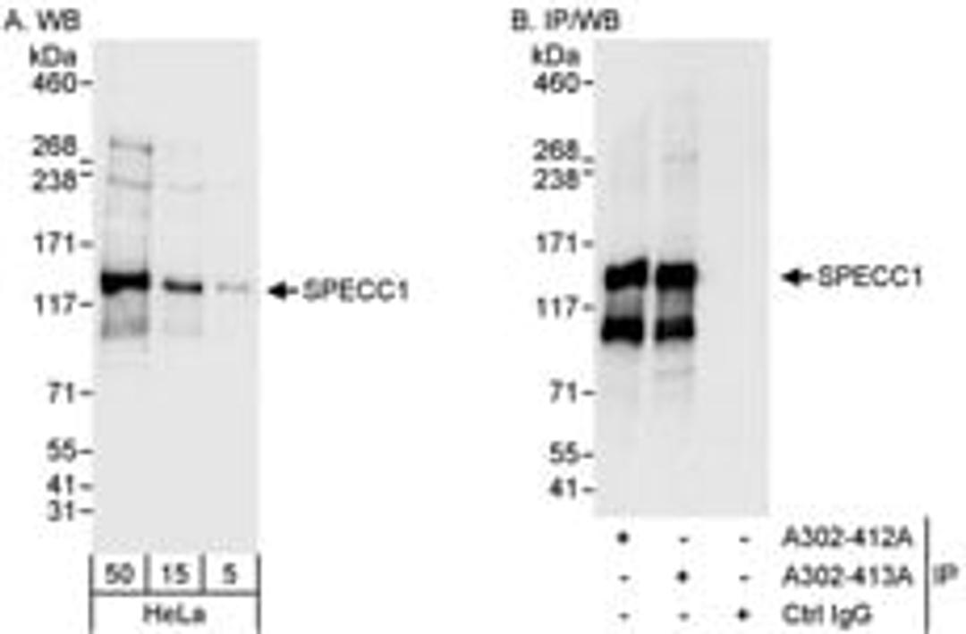 Detection of human SPECC1 by western blot and immunoprecipitation.