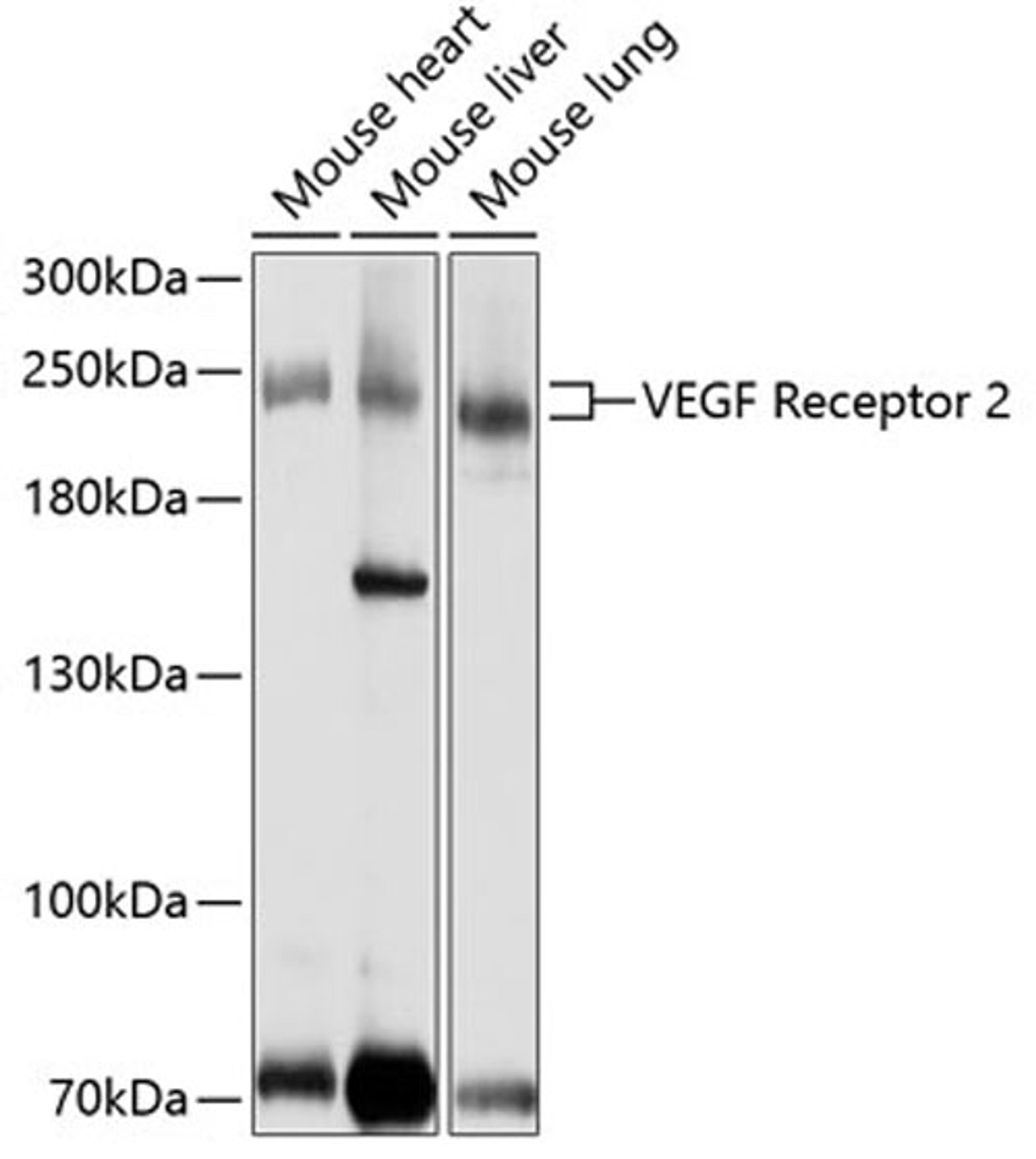 Western blot - VEGF Receptor 2 antibody (A11127)