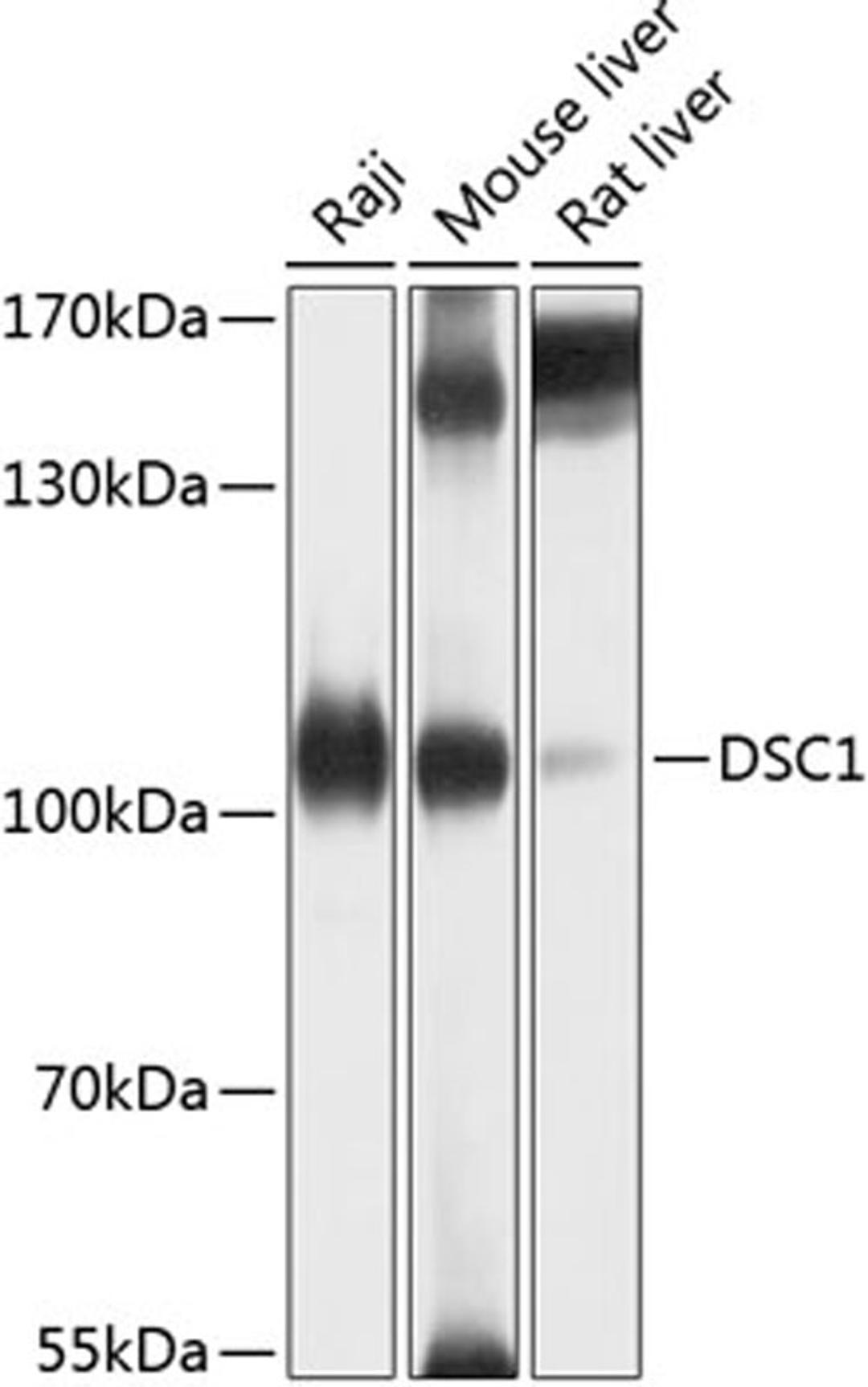 Western blot - DSC1 antibody (A10061)