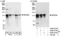 Detection of human and mouse NEDD4L by western blot (h&m) and immunoprecipitation (h).