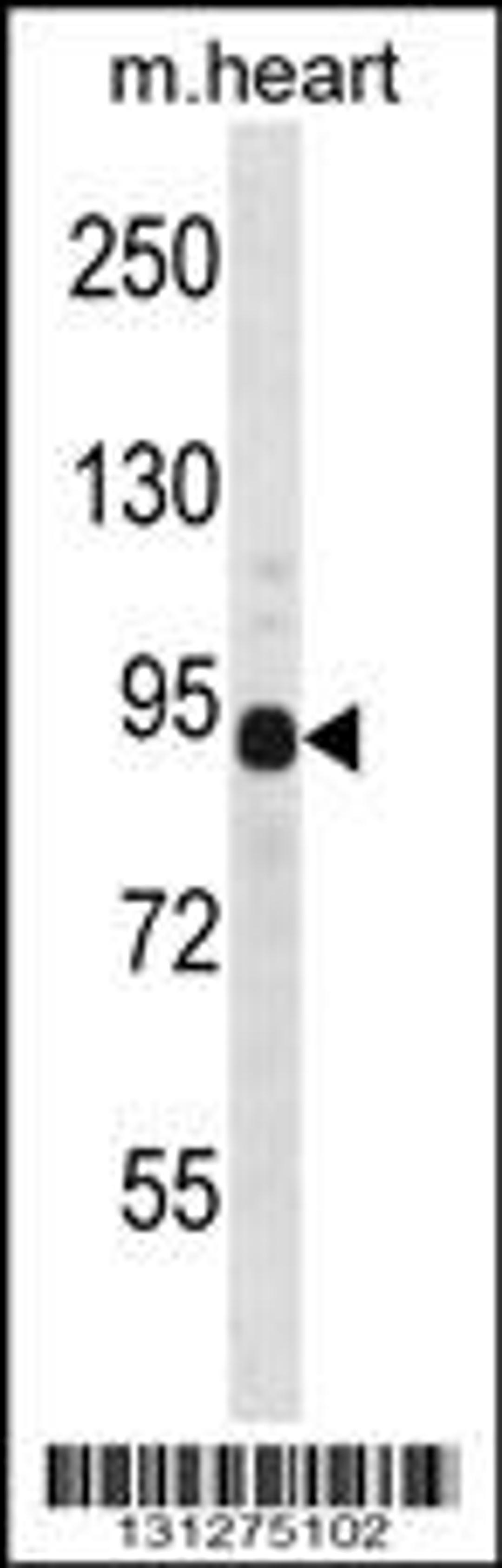 Western blot analysis in mouse heart tissue lysates (35ug/lane).