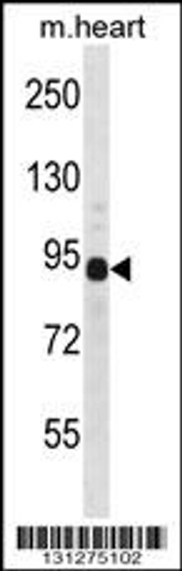 Western blot analysis in mouse heart tissue lysates (35ug/lane).