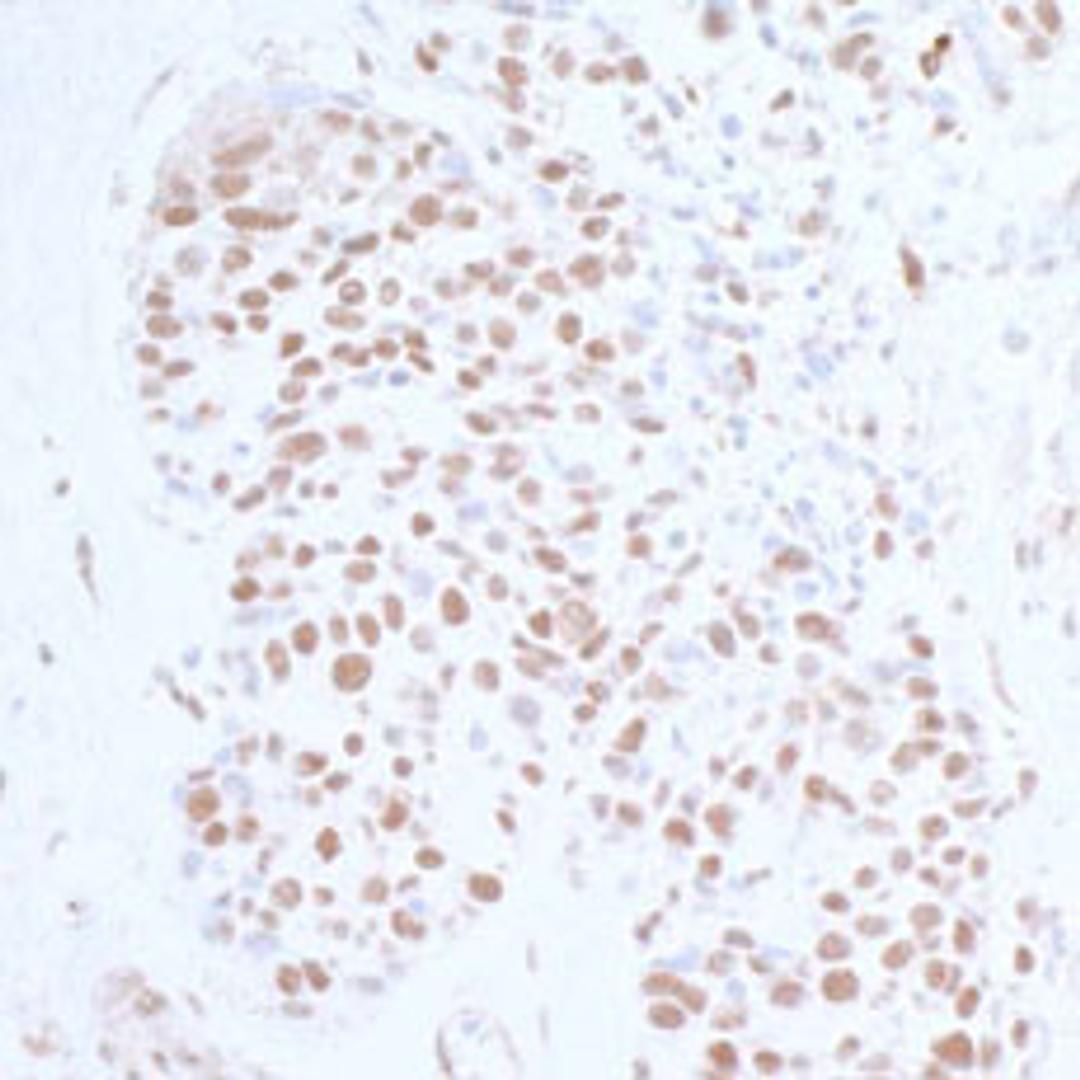 Detection of human Topo II Beta by immunohistochemistry.