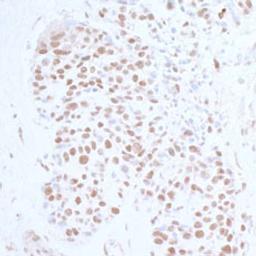 Detection of human Topo II Beta by immunohistochemistry.