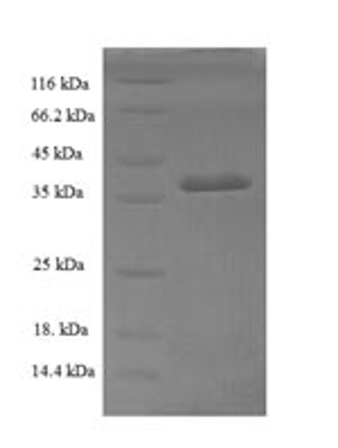 (Tris-Glycine gel) Discontinuous SDS-PAGE (reduced) with 5% enrichment gel and 15% separation gel.