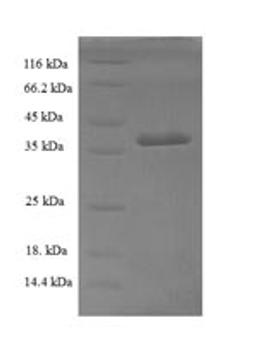 (Tris-Glycine gel) Discontinuous SDS-PAGE (reduced) with 5% enrichment gel and 15% separation gel.