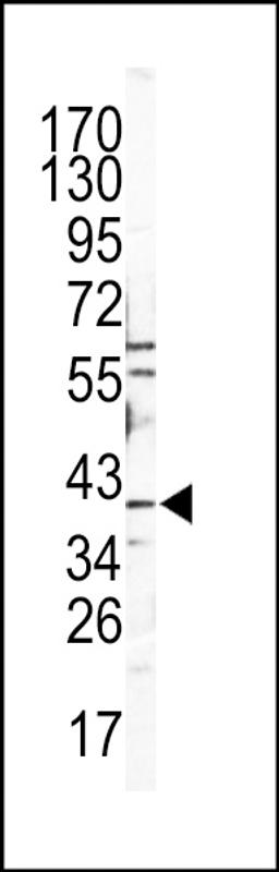 Western blot analysis of CATB Antibody in Y79 cell line lysates (35ug/lane)