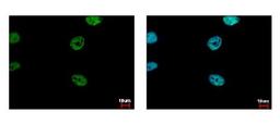 Immunocytochemistry/Immunofluorescence: FLI1 Antibody [NBP2-16500] - HeLa cells were fixed in 4% paraformaldehyde at RT for 15 min. Green: FLI1 protein stained by FLI1 antibody diluted at 1:500. Blue: Hoechst 33343 staining.