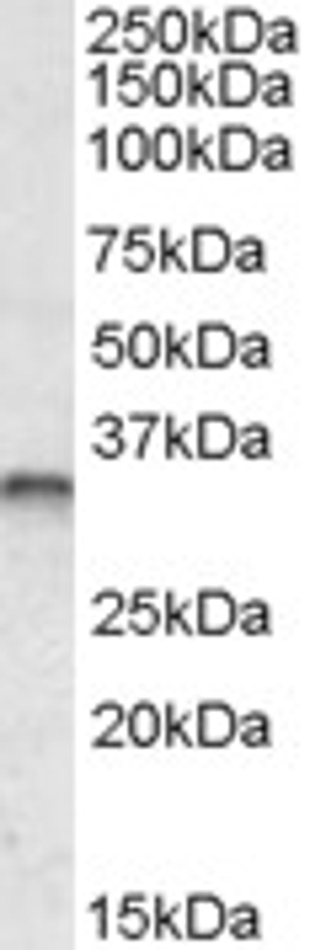 42-004 (0.3ug/ml) staining of Human Breast Cancer lysate (35ug protein in RIPA buffer). Primary incubation was 1 hour. Detected by chemiluminescence.