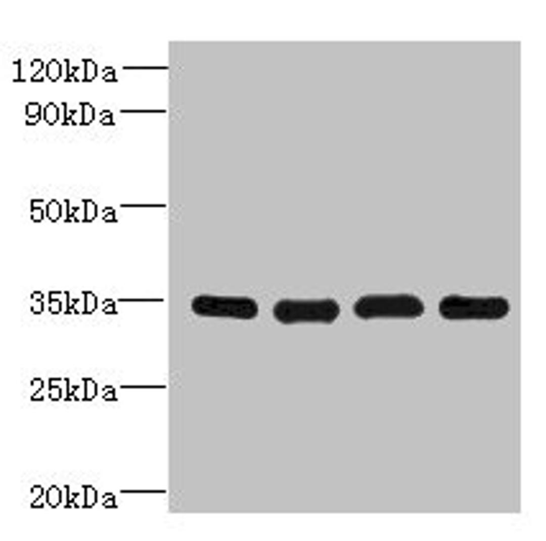 Western blot. All lanes: DNAJC17 antibody at 16ug/ml. Lane 1: A431 whole cell lysate. Lane 2: Hela whole cell lysate. Lane 3: Raji whole cell lysate. Lane 4: HepG2 whole cell lysate. Secondary. Goat polyclonal to rabbit IgG at 1/10000 dilution. Predicted band size: 35 kDa. Observed band size: 35 kDa. 