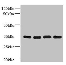 Western blot. All lanes: DNAJC17 antibody at 16ug/ml. Lane 1: A431 whole cell lysate. Lane 2: Hela whole cell lysate. Lane 3: Raji whole cell lysate. Lane 4: HepG2 whole cell lysate. Secondary. Goat polyclonal to rabbit IgG at 1/10000 dilution. Predicted band size: 35 kDa. Observed band size: 35 kDa. 