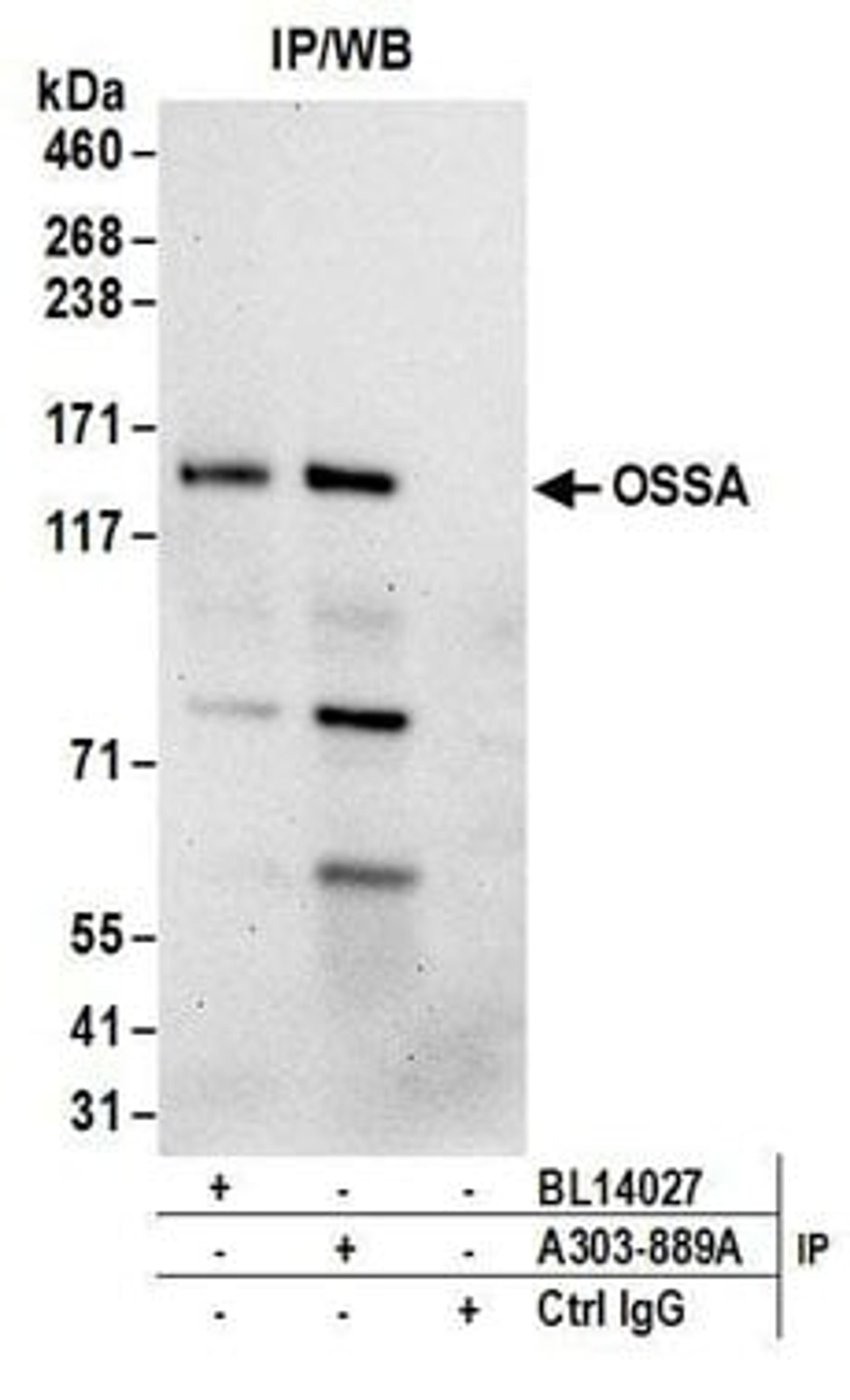 Detection of human OSSA by western blot of immunoprecipitates.