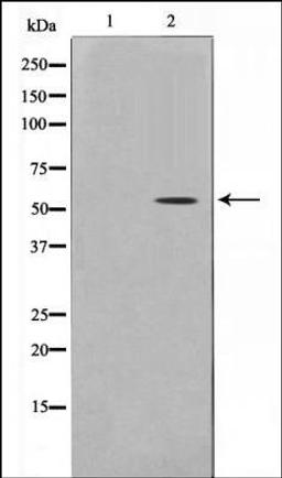 Western blot analysis of mouse brain using Smad 6 antibody