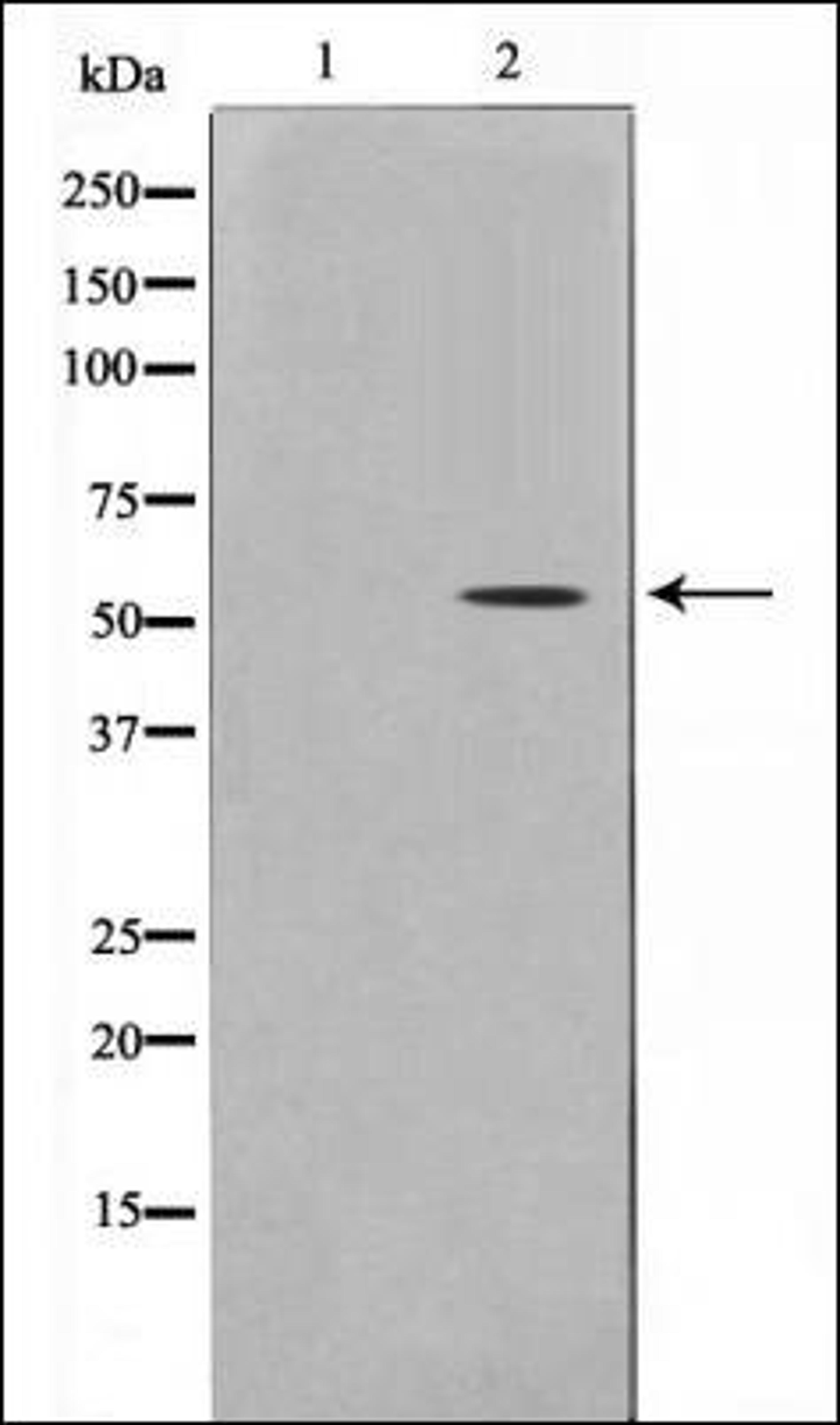 Western blot analysis of mouse brain using Smad 6 antibody