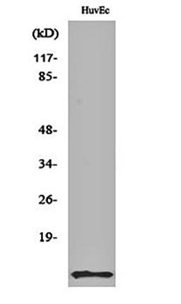 Western blot analysis of HuvEc cell lysates using ACBP antibody