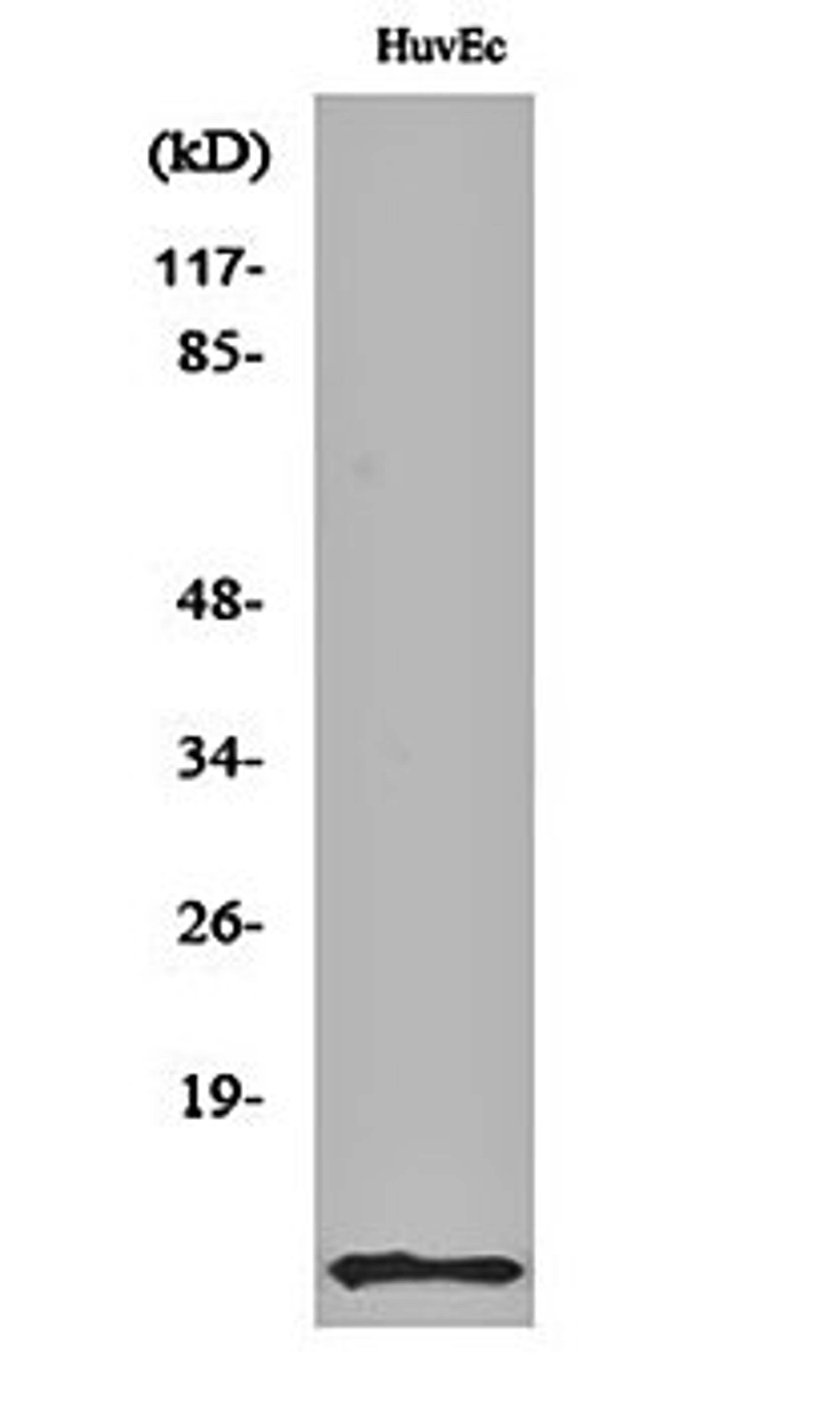 Western blot analysis of HuvEc cell lysates using ACBP antibody