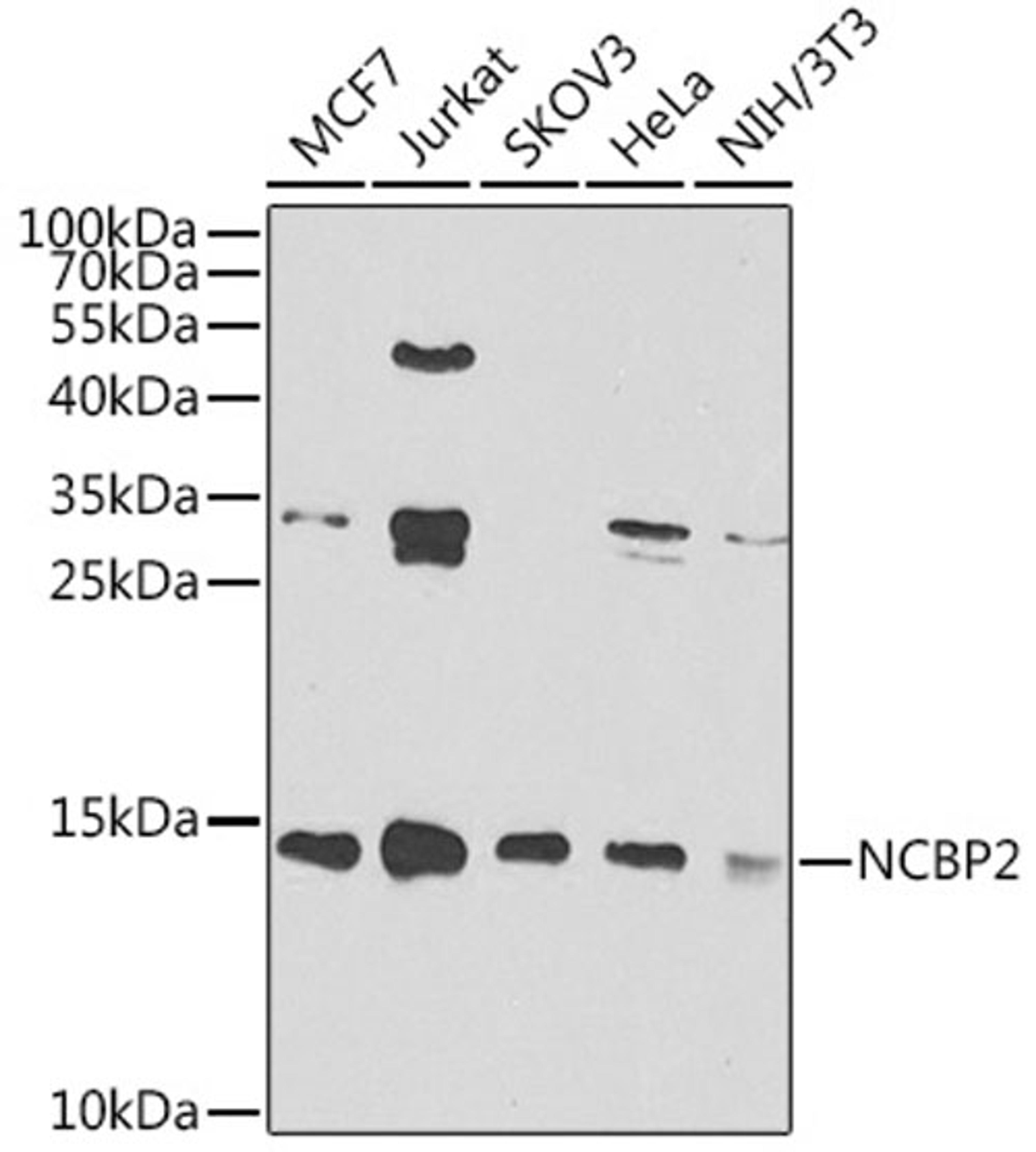 Western blot - NCBP2 antibody (A7293)