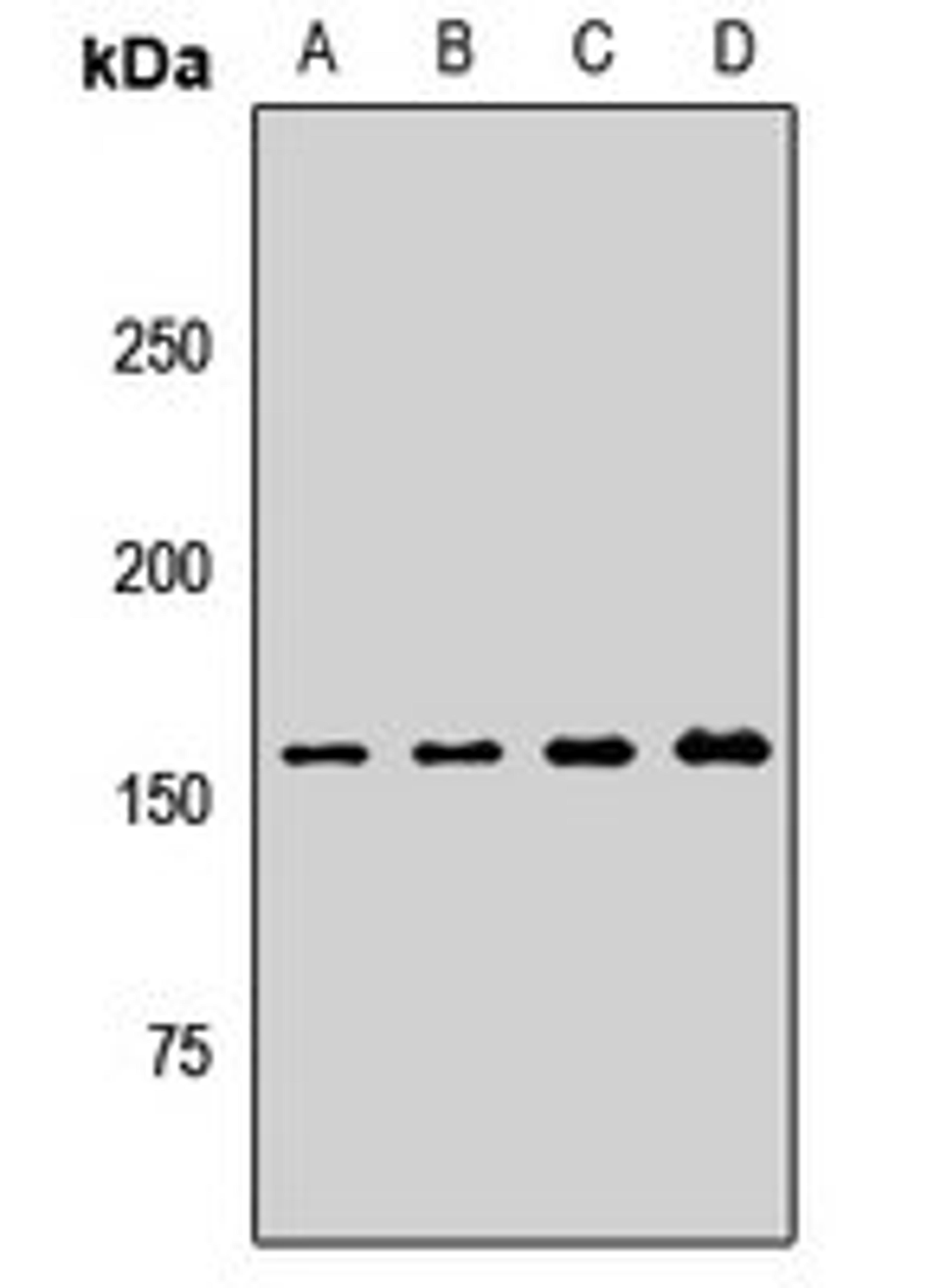 Western blot analysis of HEK293T (Lane1), Hela (Lane2), mouse liver (Lane3), rat liver (Lane4) whole cell lysates using ARAP1 antibody