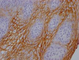 IHC image of CSB-MA995583 diluted at 1:100 and staining in paraffin-embedded human tonsil tissue performed on a Leica BondTM system. After dewaxing and hydration, antigen retrieval was mediated by high pressure in a citrate buffer (pH 6.0). Section was blocked with 10% normal goat serum 30min at RT. Then primary antibody (1% BSA) was incubated at 4°C overnight. The primary is detected by a Goat anti-mouse IgG polymer labeled by HRP and visualized using 0.05% DAB.