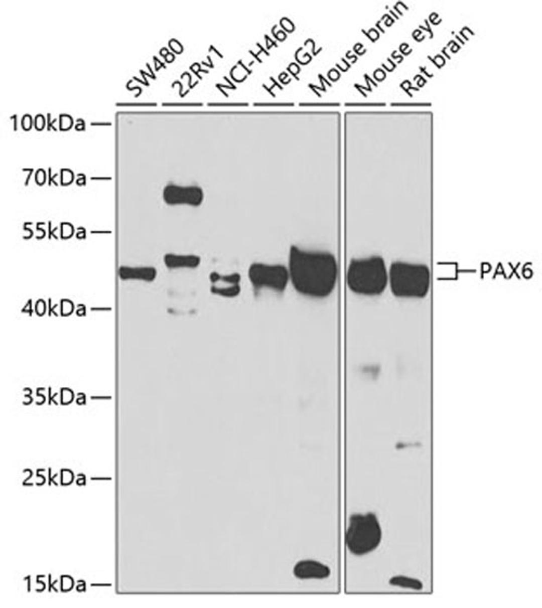 Western blot - PAX6 antibody (A7334)