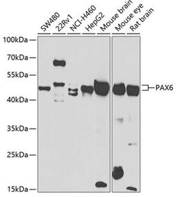 Western blot - PAX6 antibody (A7334)