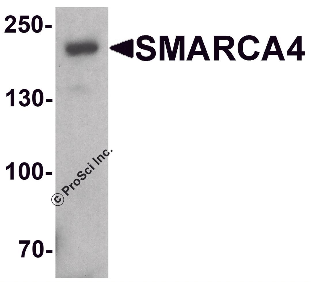 Western blot analysis of SMARCA4 in SK-N-SH cell lysate with SMARCA4 antibody at 1 &#956;g/ml.