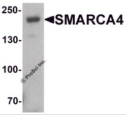 Western blot analysis of SMARCA4 in SK-N-SH cell lysate with SMARCA4 antibody at 1 &#956;g/ml.