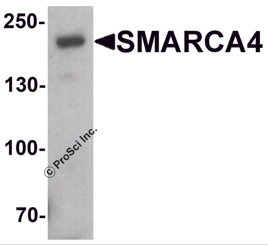 Western blot analysis of SMARCA4 in SK-N-SH cell lysate with SMARCA4 antibody at 1 μg/ml.