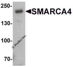 Western blot analysis of SMARCA4 in SK-N-SH cell lysate with SMARCA4 antibody at 1 μg/ml.
