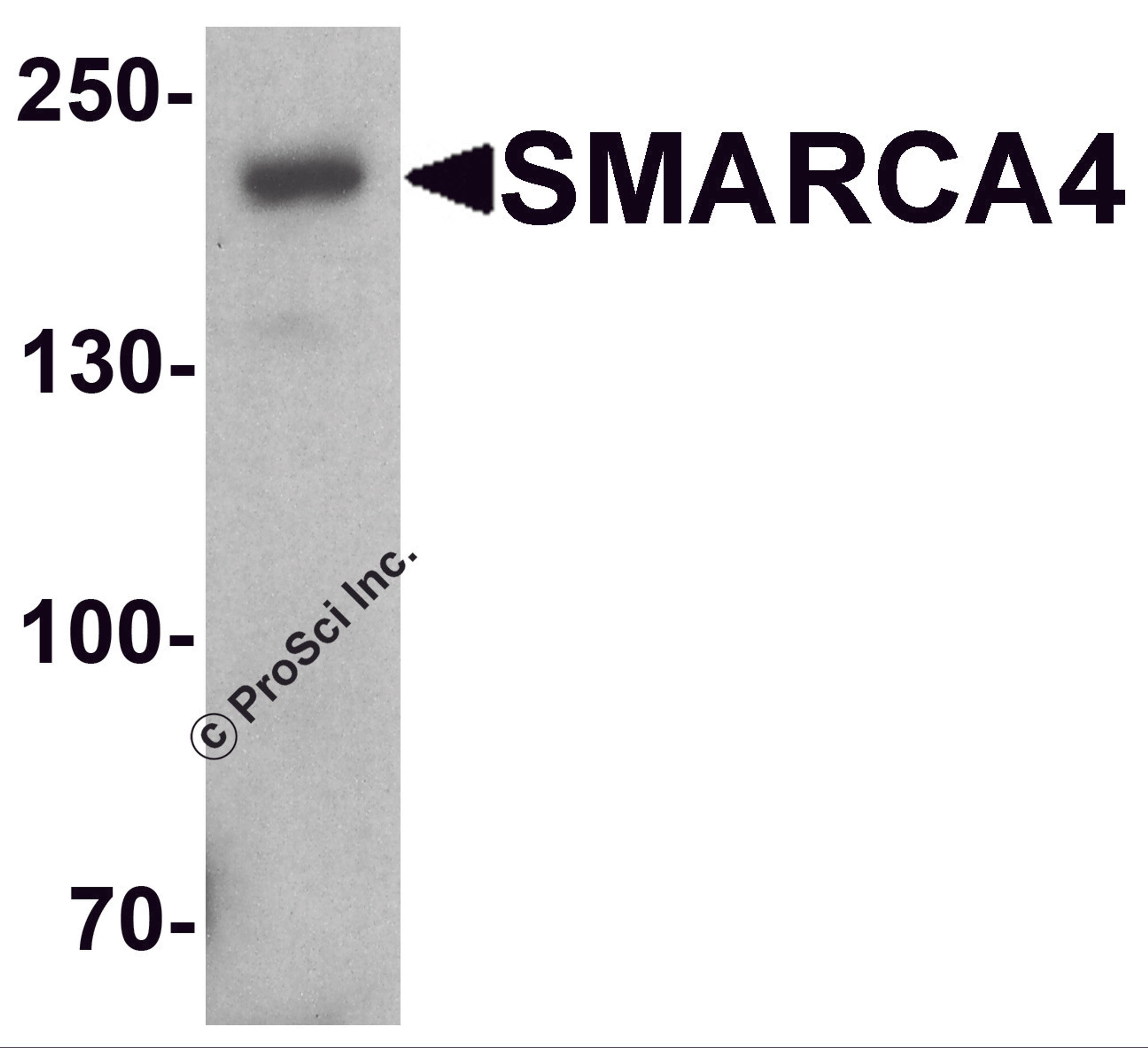 Western blot analysis of SMARCA4 in SK-N-SH cell lysate with SMARCA4 antibody at 1 μg/ml.