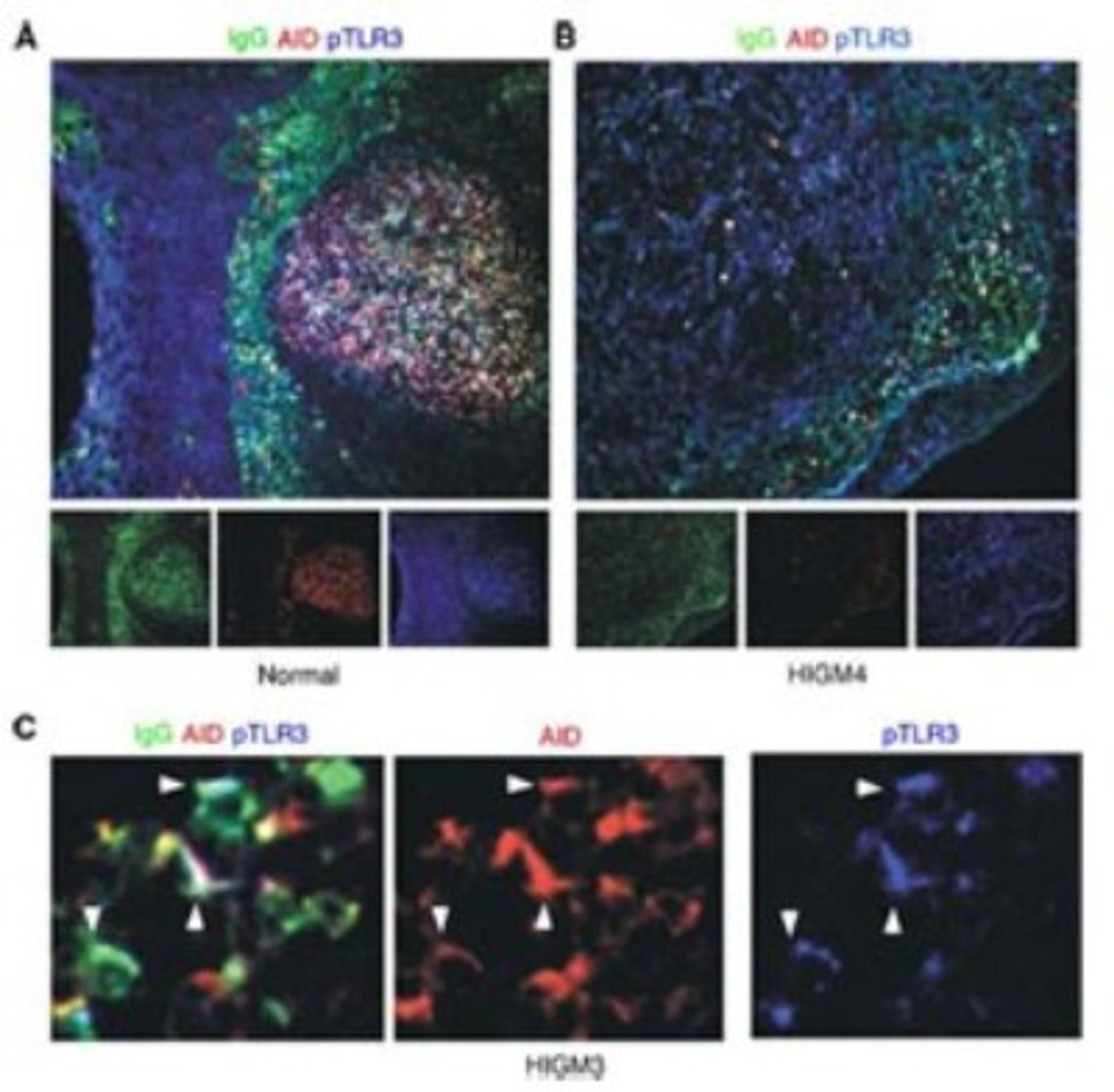 Immunocytochemistry/Immunofluorescence: TLR3 [p Tyr759] Antibody [NBP2-24904] - Analysis of IgG, AID and TLR3 (A) and a hyper-IgM (HIGM) syndrome patient (B and C). A and B: Paraformaldehyde-fixed, frozen tonsillar mucosa tissue sections. C. Paraformaldehyde-fixed, mucosal B cells from the colon lamina propria of the HIGM patient. Arrowheads indicate cells co-expressing phospho TLR3, AID, and IgG. Data courtesy of W. Xu. et. al., and the Journal of Immunology