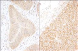 Detection of human and mouse DDX6 by immunohistochemistry.